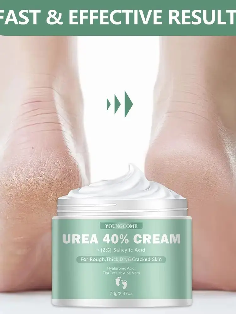 Urea Cream 40% + 2% Salicylic Acid, YOUNGCOME Moisturizing Cream with Hyaluronic Acid Tea Tree Aloe Vera, Long-Lasting Hydration