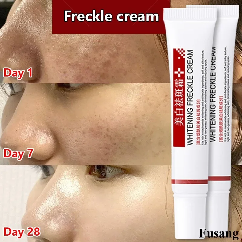 Niacinamide Face Freckles Cream for Women Remove Melasma Dark Spots Lotion Lighten Melanin Whitening Cream Skin Brightening Care