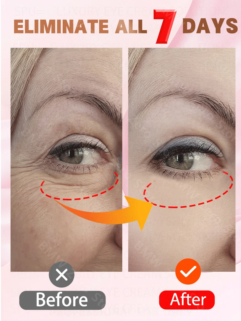 

eye bag removal cream