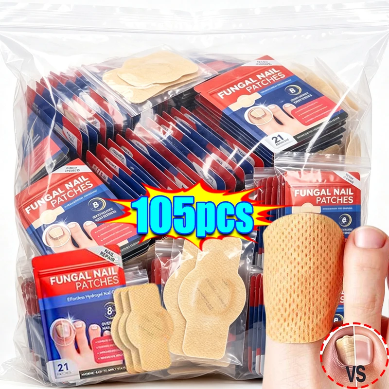 105/21pcs Nail Repair Patches Toenail Fungus Patch Care Nail Inlay Correction Sticker Paronychia Disposable Toenail Patches
