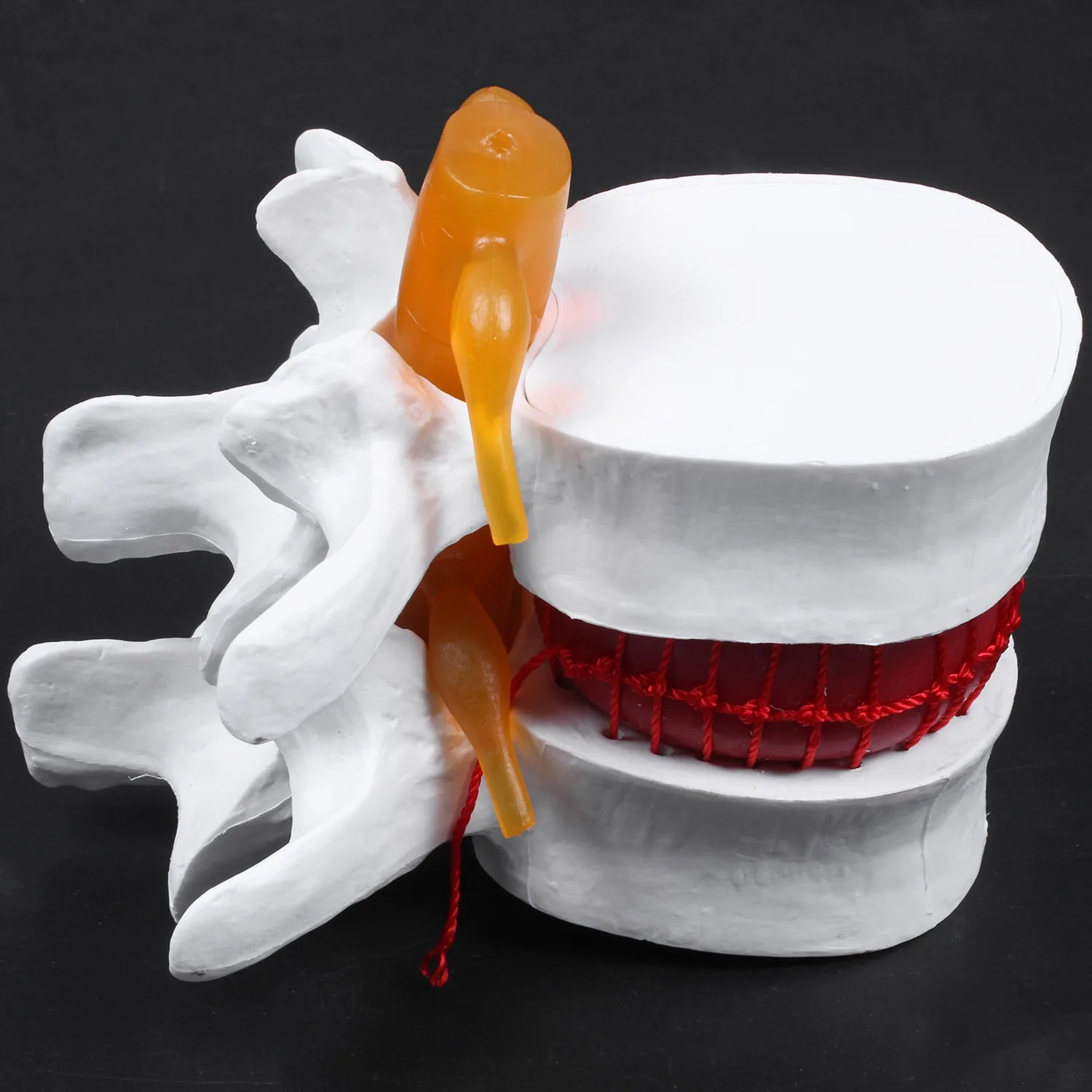Esqueleto de anatomía humana, columna vertebral, hernia de disco Lumbar, modelo de enseñanza, cráneo cerebral, suministros escolares traumáticos, instrumento