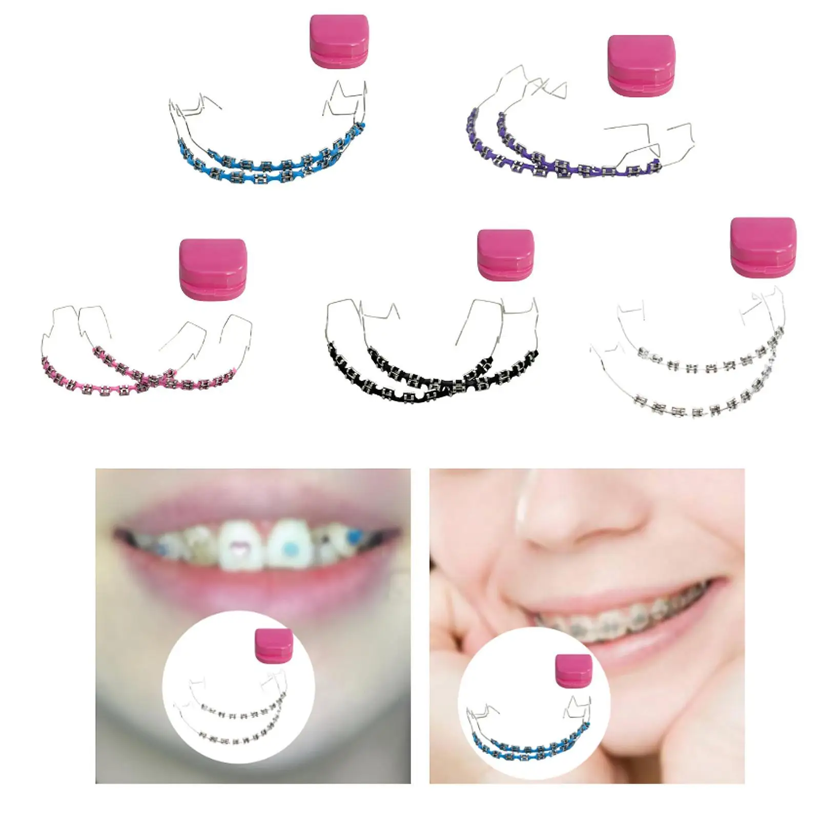 

Temporary Dental Decoration DIY Color Braces Decoration Chain for Teens Kids