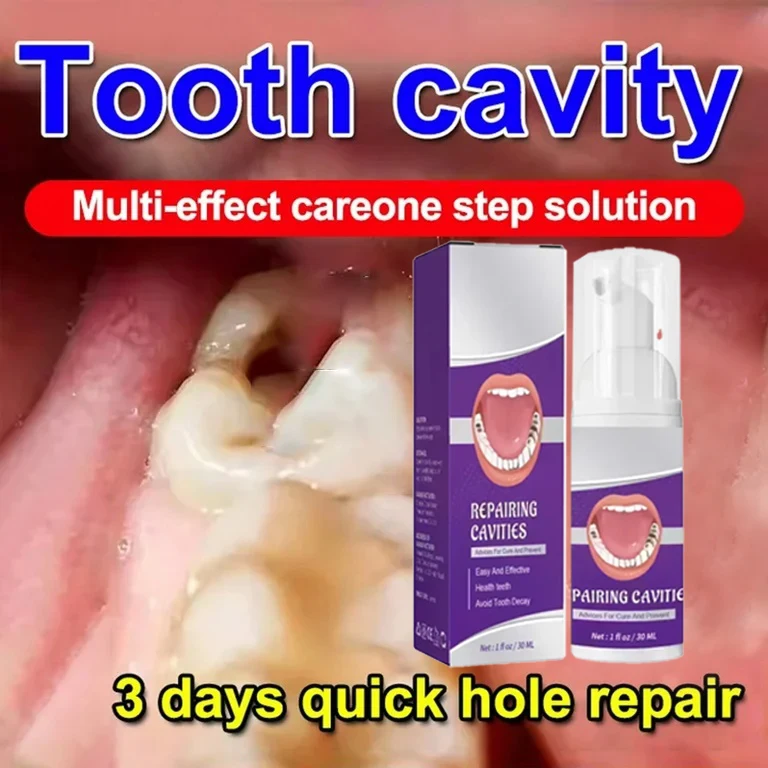 Teeth Cleaning Toothpaste Removes Tooth Stains Teeth Whitening Tooth decay repair  Calculus Plaque Periodontitis Remove Cavities