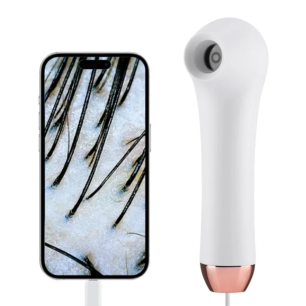 

Portable Hair Scalp Skin Detector Protects Profession Hd Visual Scopes Camera Scalp Detector Blackhead Pore Mini Analyzer Health