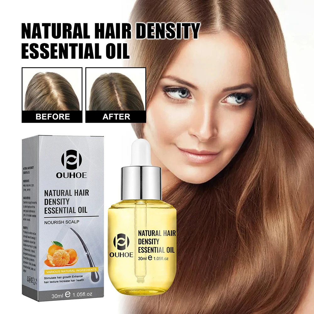 Aceite de jengibre para el crecimiento del cabello para hombres y mujeres, aceite esencial de masaje para el cuero cabelludo, anticaída, hidrata las raíces de reparación densa, 30ml
