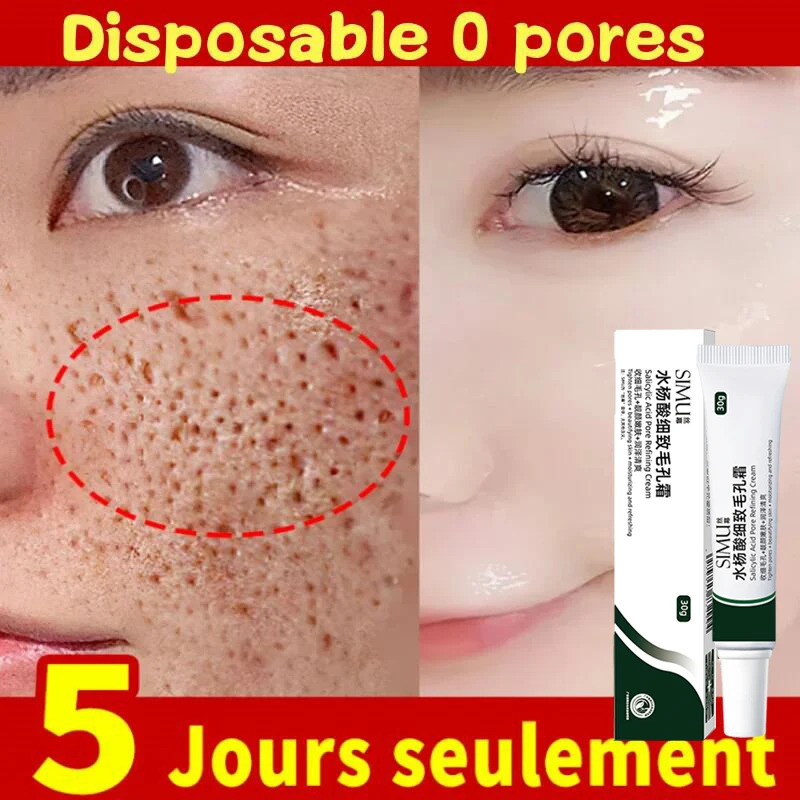 Salicylic Acid Pores Shrink Refining Cream Repair Large Open Pore Remove Black Dots Blackhead Acne Marks Face Skin Care Products