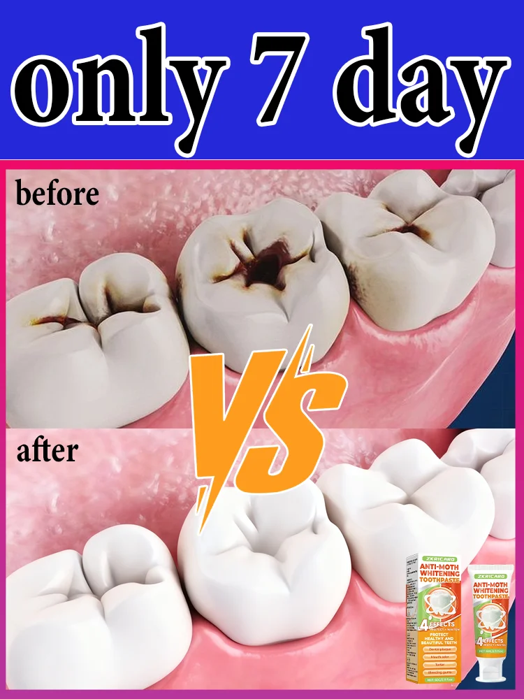 

Sᴄɪᴇɴᴛɪғɪᴄ Rᴇᴘᴀɪʀs Cᴀᴠɪᴛɪᴇs, Cʟᴇᴀɴs Pʟᴀᴏ̨ᴜᴇ, Wʜɪᴛᴇɴs Tᴇᴇᴛʜ