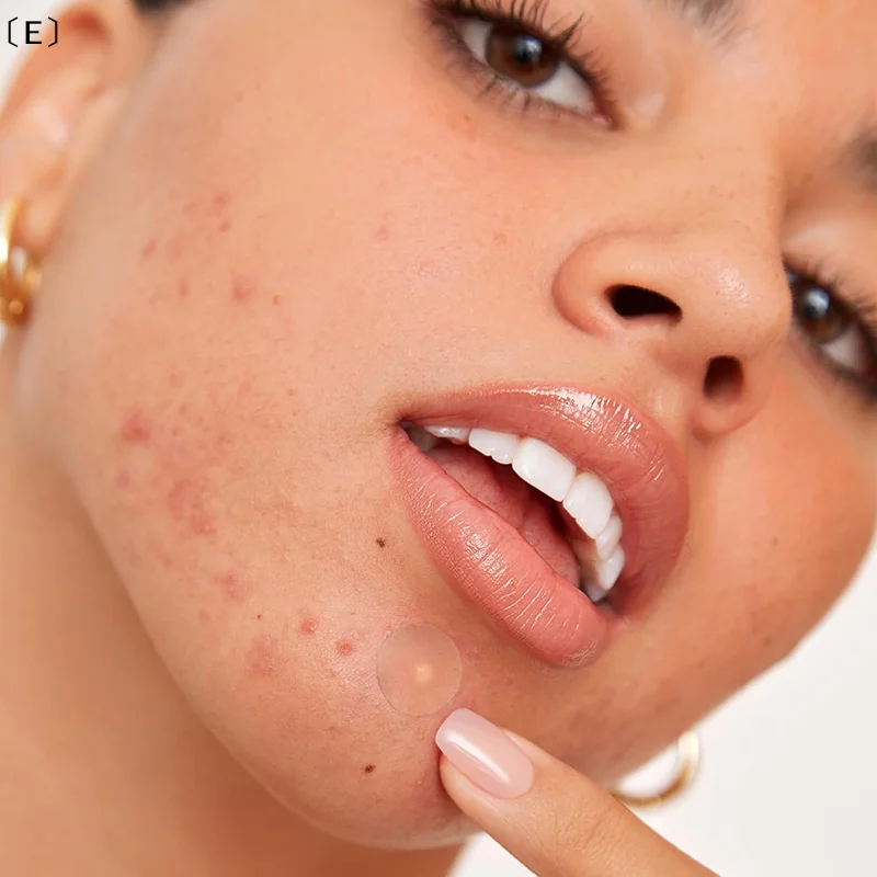 〔E〕360Pcs Invisible Pimple Rem - đánh giá và giá Beauty Zone Makeup