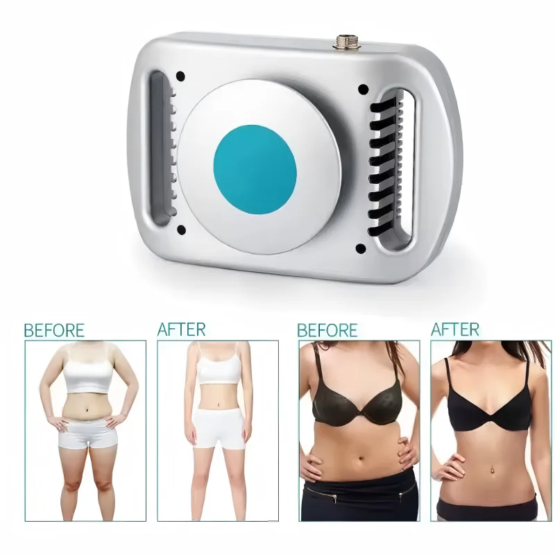 

Fat Freezing Cryotherapy Slimming Machine Body Fat Burner Belly Shaping Belt Cold Therapy Liposuction For Fat Removal Device