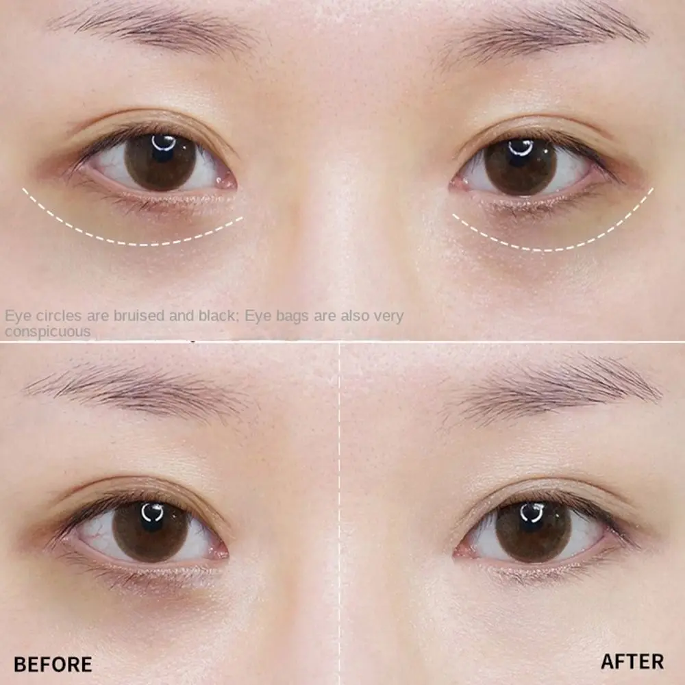 ปกปิดจุดด่างดำ บำรุงผิวหน้า คอนซีลเลอร์ ครีมรองพื้น ครีมปกปิดเต็มรูปแบบ ครีมปกปิดรอยคล้ำใต้ตา รองพื้นชนิดน้ำ