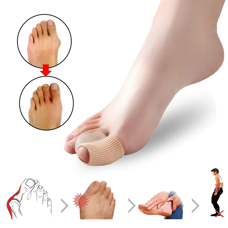 Separador de dedos para pedicura, Protector de silicona para el cuidado de los pies, alisador ortopédico, Corrector de juanetes, Hallux Valgus