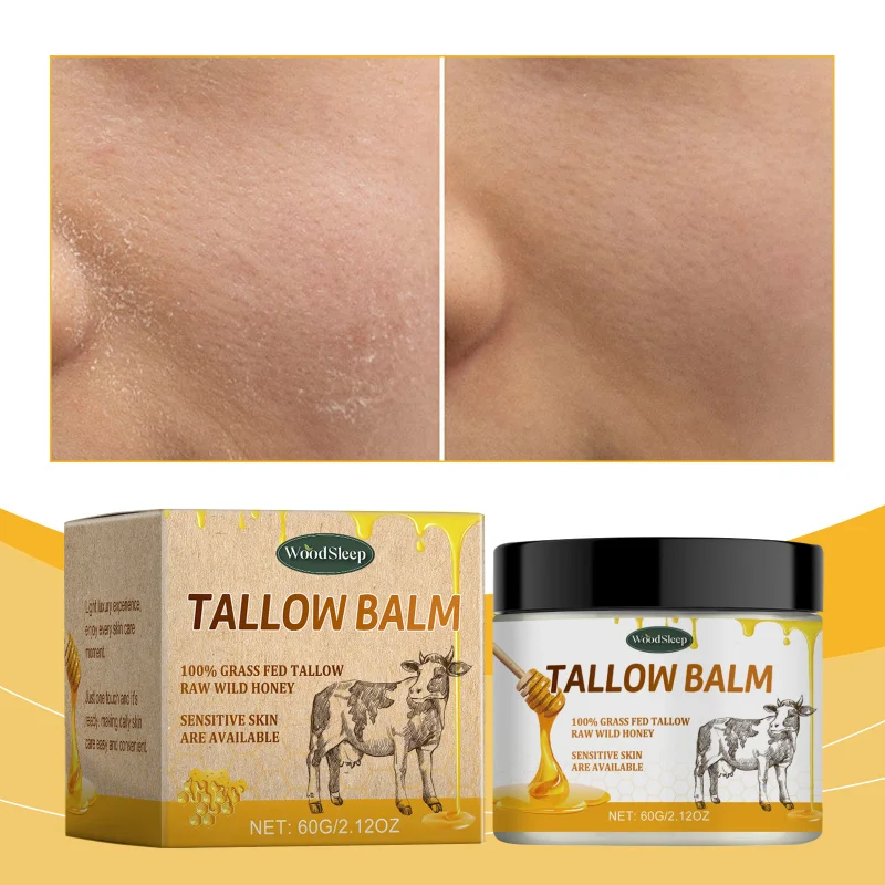 

Grass-Fed Beef Tallow Moisturizing Cream, Hydrate Nourish For Soft Smooth Skin, All-Season Use & Long-Lasting Hydration