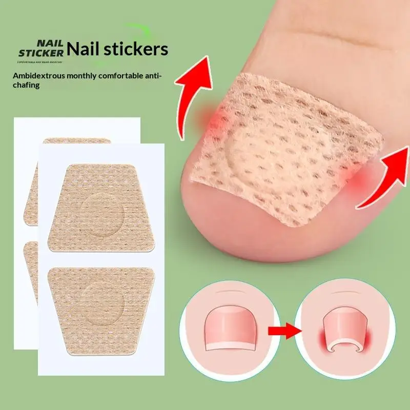 50 Sheets Gentle And Breathable Nail Ingrown Correction Sticker Miracle Tea Tree Oil Nail Patch Suitable For Toenails