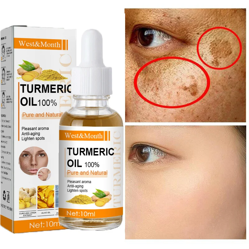 Turmeric Whitening Freckles Serum Remove Melasma Dark Spots  Lighten Melanin Improve Dull Brighten Moisturizing Facial Skin Care