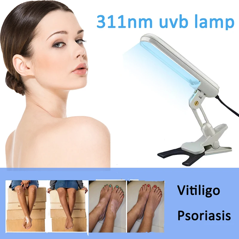 

Excimer Laser 311nm Psoriasis Vitiligo Laser Machine Uvb Lamps for Psoriasis Treatment Nb Uvb Lamp for Vitiligo