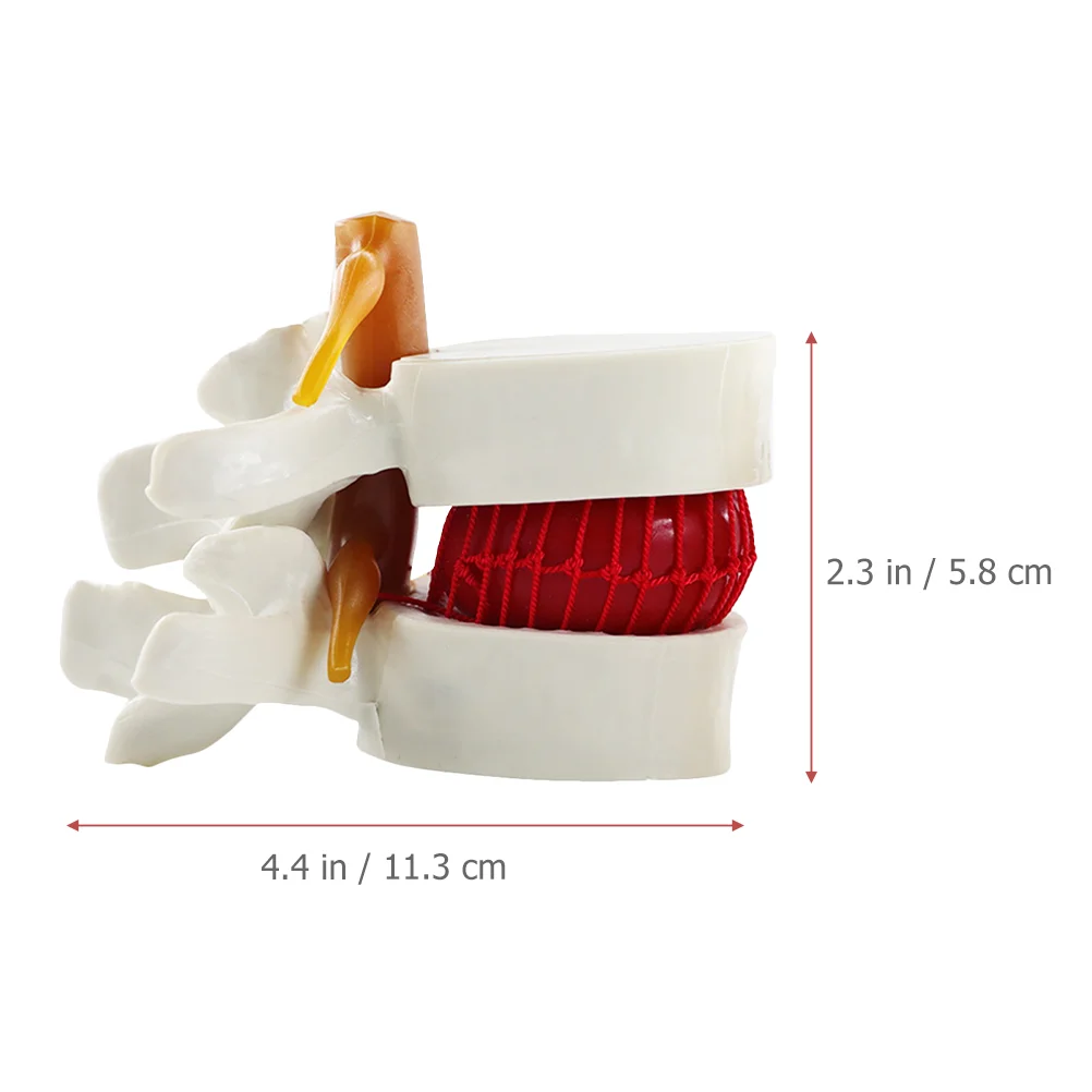 Models Intervertebral Disc Lumbar Vertebrae Degenerative Human Body Herniation Demonstrating Spine for Teaching White