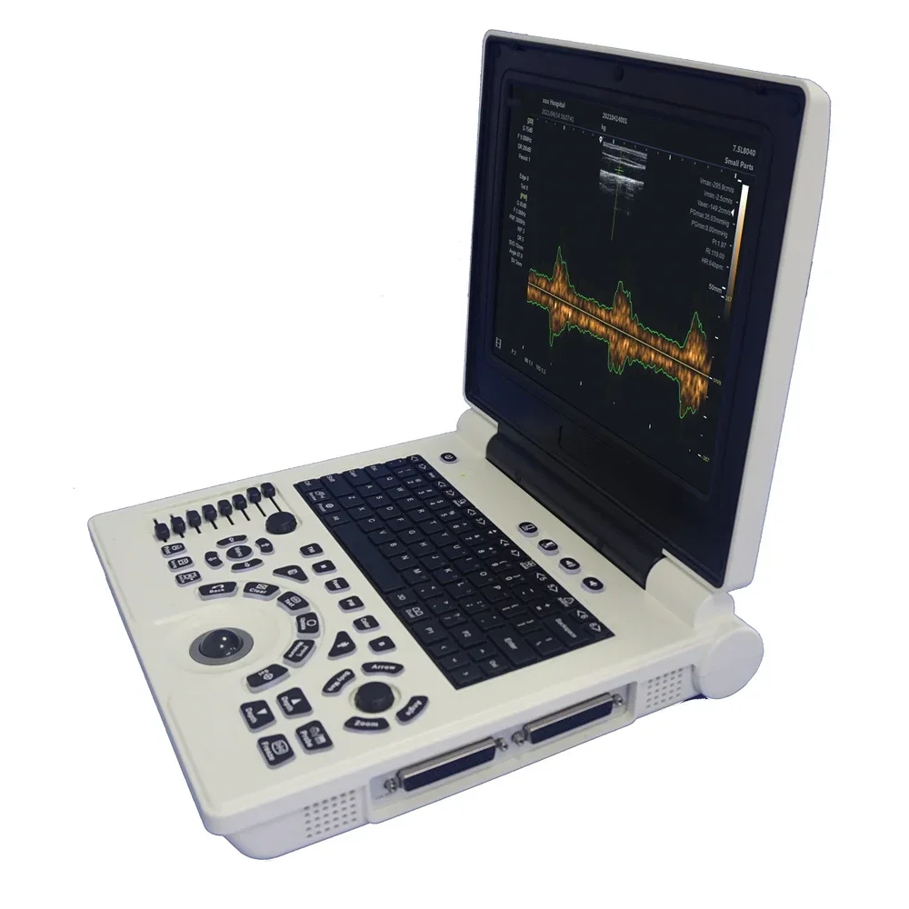 Economical 12inch Led Human Color Doppler Notebook Ultrasound Scanner Machine PC Based