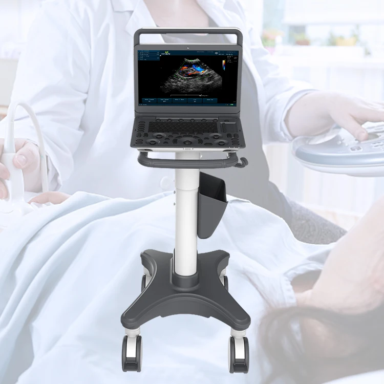 sonoscape e1 exp expert machine 4d ultrasound