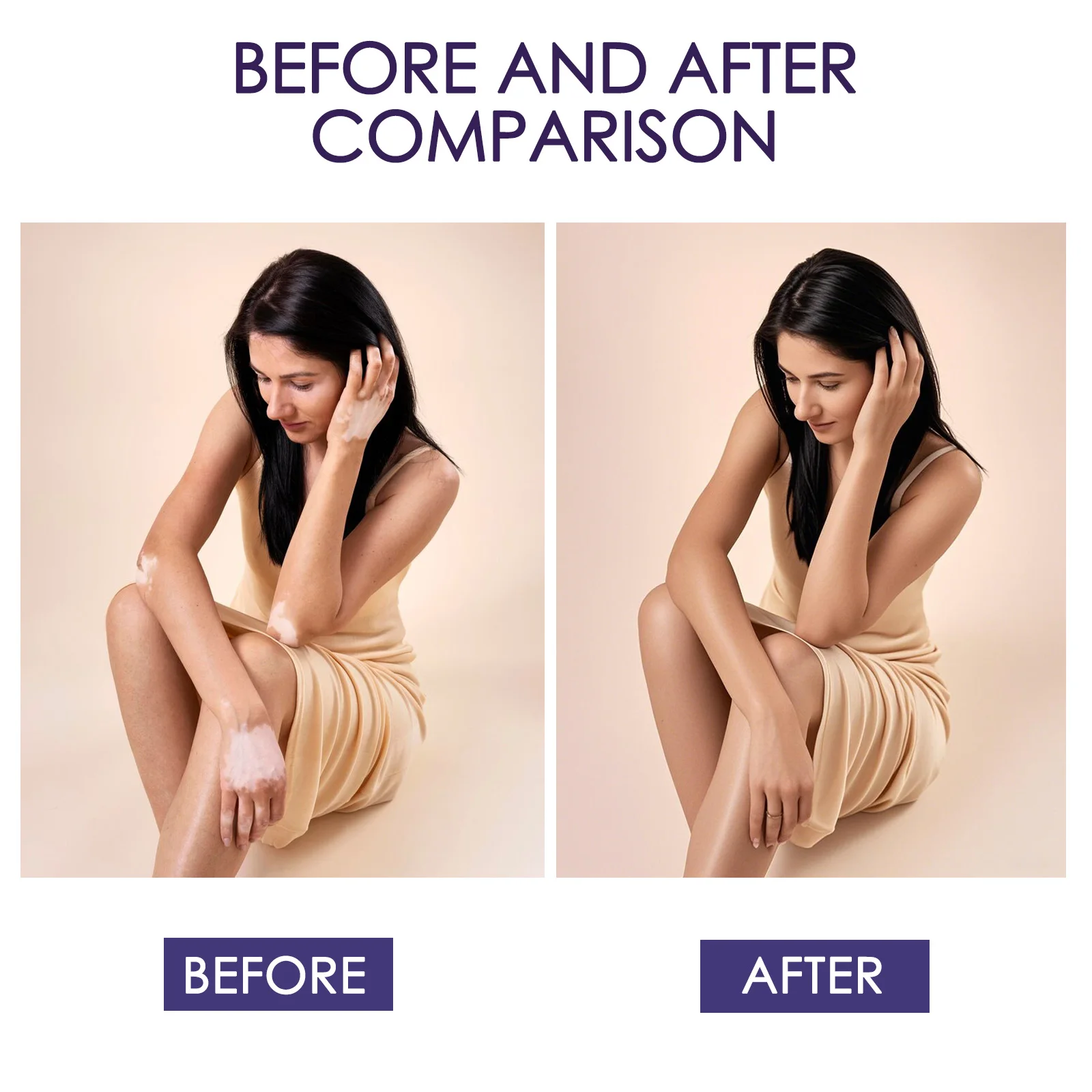 103ML Tattoo Body Concealer Make Langdurige Waterdichte Tattoo/Litteken/Vlekken Hoge Cover Crème Body Coverage Foundation crème