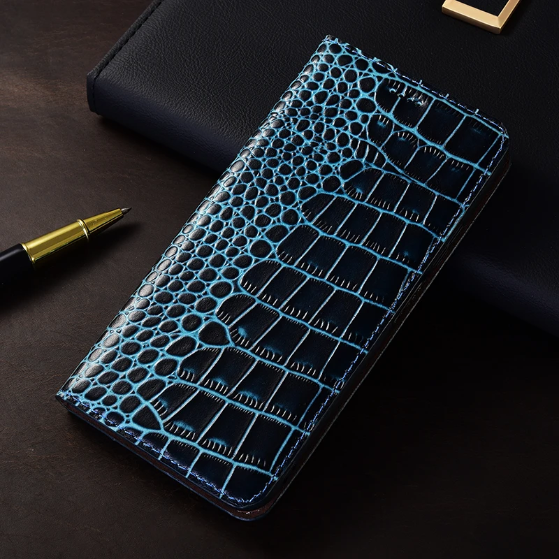 حافظة جلدية أصلية من جلد التمساح لهاتف OPPO Find X8 X8S X9 Pro Plus Ultra حافظة بطاقات مقاومة للخدش #1