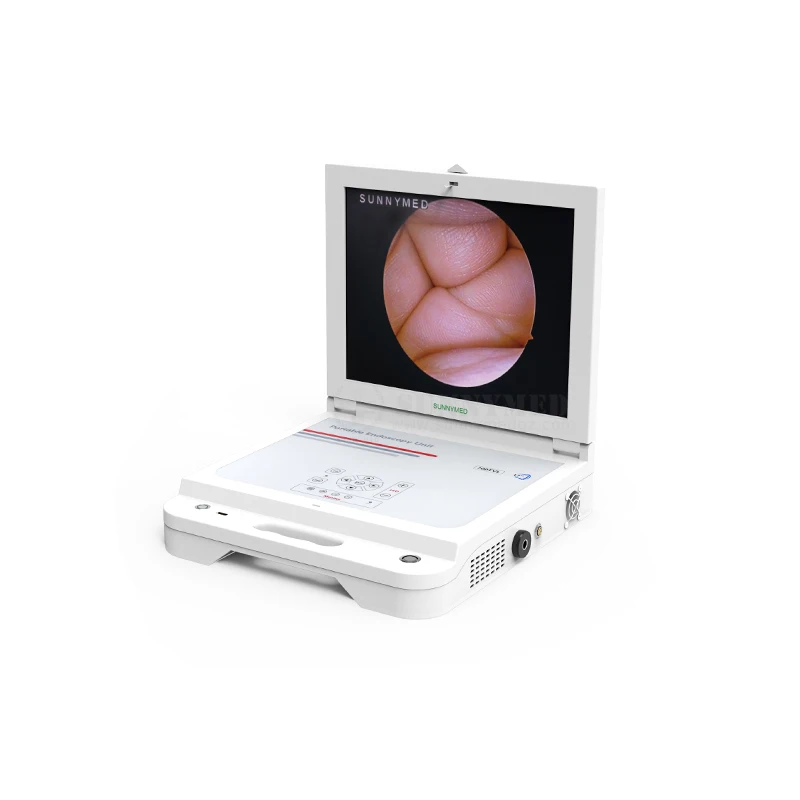 

SY-PS045N Portable Integrated Rigid Video Endoscopy System for Surgery