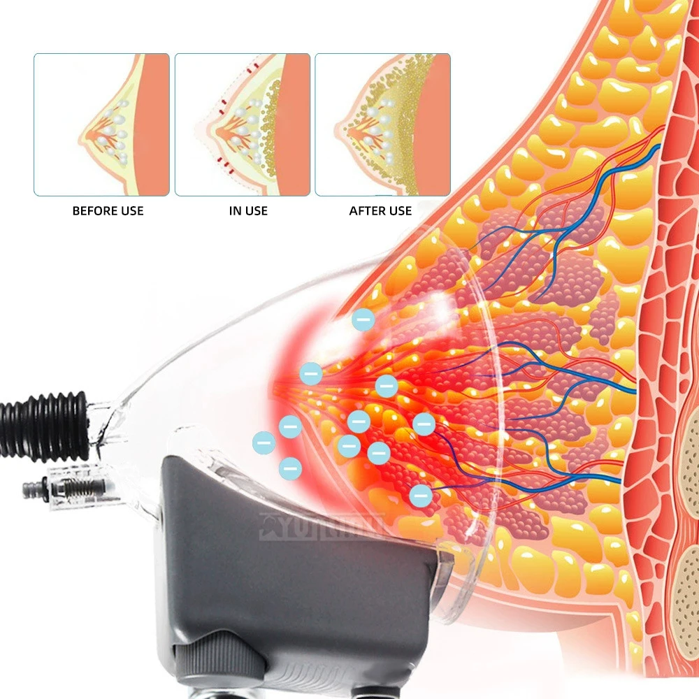 Breast enlargement instrument, breast beautification, breast massage