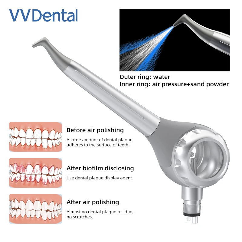 VV Dental 2/4 Holes Teeth Whitening Sandblasting Gun Double-Sided Transparent Window Detachable Cover Polishing Alumina Polisher