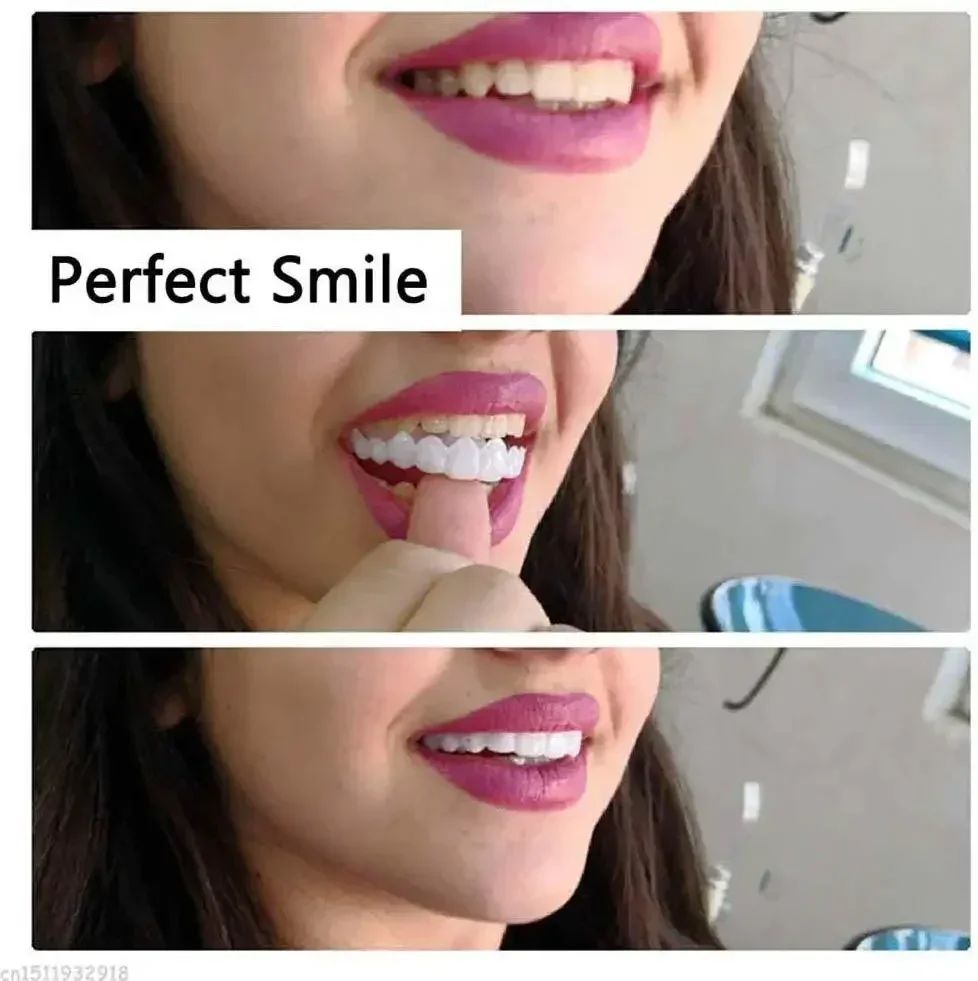 Sdotter 2Pcs Perfect Fit Teeth Whitening Fake Tooth Cover Snap On Silicone Smile Veneers Teeth Upper Beauty Tool