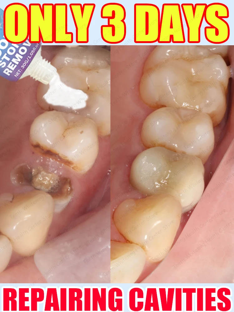 #49 New Dentures Arrivals