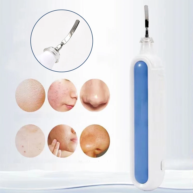 1 pçs facial ultra sônico peeling vibrador substituído cabeça para poros limpeza nariz rosto mancha cuidados com a pele ferramenta de beleza de aço inoxidável