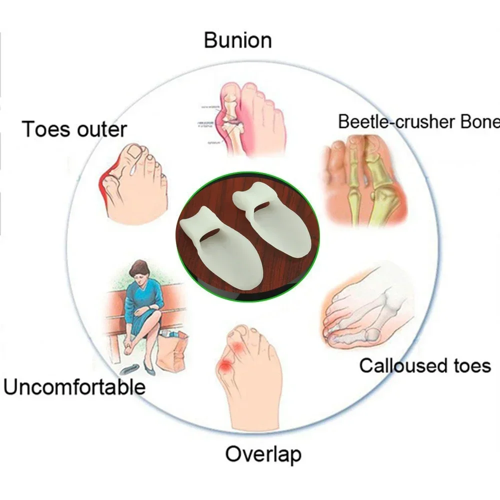 ซิลิโคนเจล Bunion Splint Big Toe Separator ทับซ้อนกัน Spreader Corrector Hallux Valgus Foot Care เครื่องมือ Corrector De Juanetes