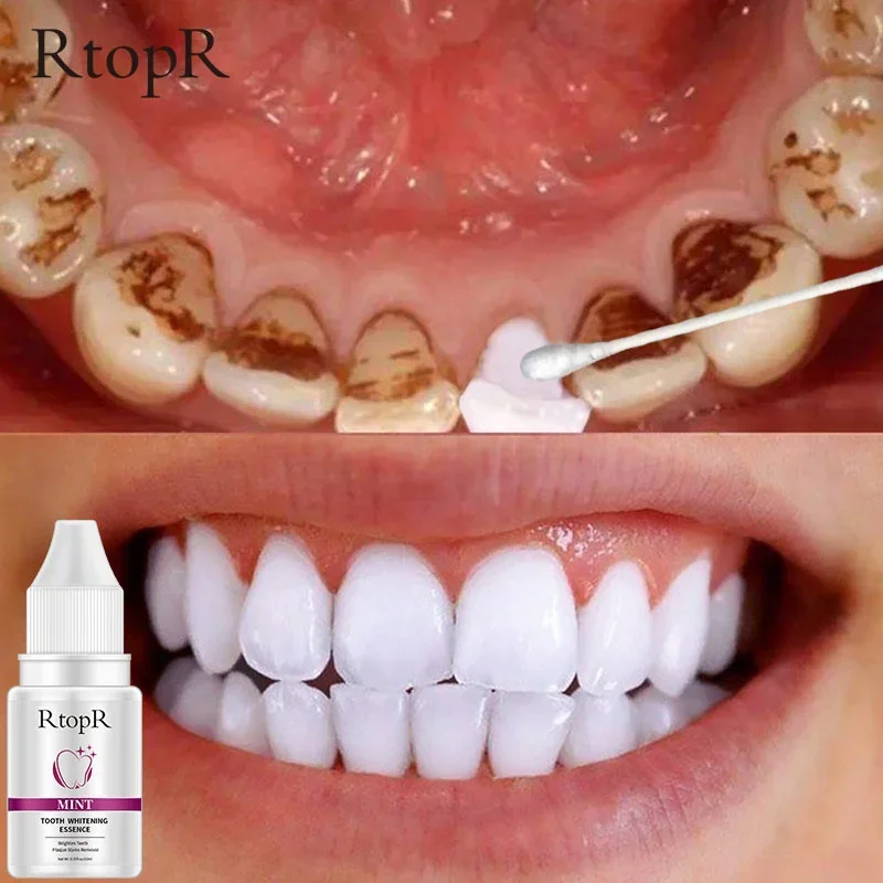 

RtopR Teeth Whitening Essence Remove Plaque Stains Oral Hygiene Bleaching Products Cleansing Fresh Breath Dentistry Care Tools