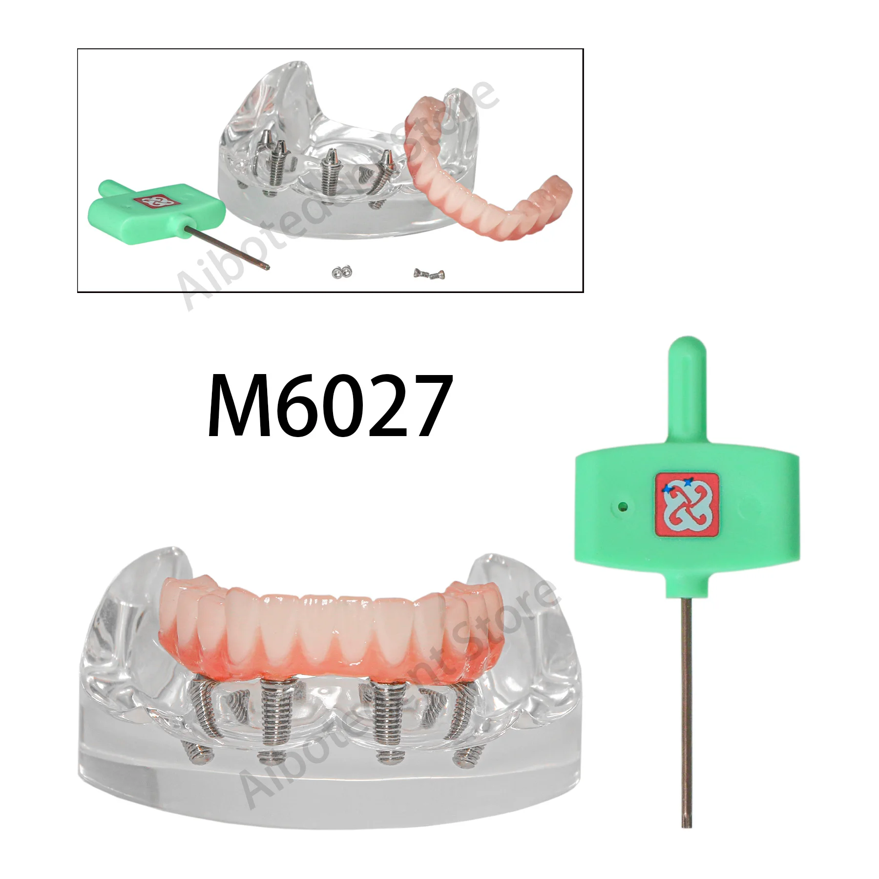 

Dental Teeth Model Mandible Implant Restoration Model 4 Removable Screws with Post Core Bridge M6027