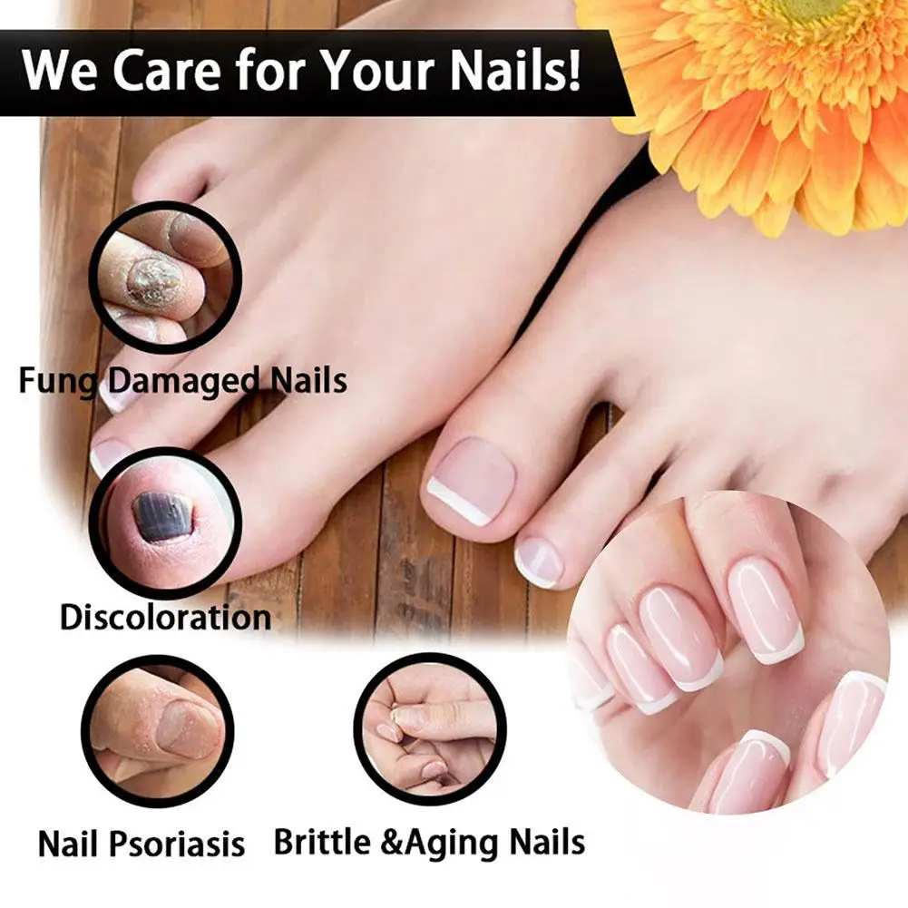 Nail Fungals Renewal Nail Repair Liquid for Discolored Thickened Crumbled Nails Nail Fungals for Discolored Broken Cracked