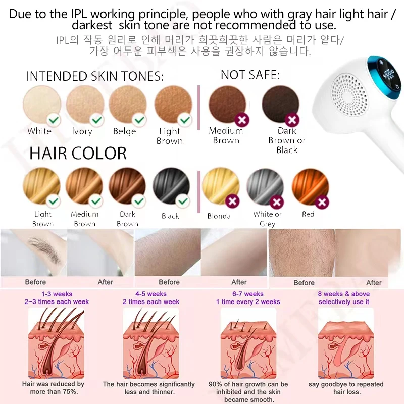 جهاز إزالة الشعر بالليزر من Ice IPL جهاز إزالة الشعر الكهربائي عقد دائم للمنزل 900000 ومضات مزيل شعر الجسم بالكامل للرجال والنساء