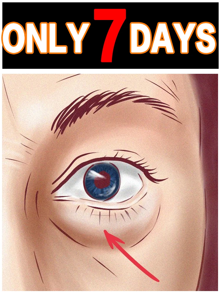 Удаляет мешки под глазами и восстанавливает нормальный внешний вид глаз.