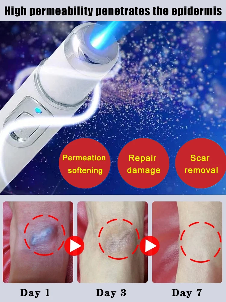 Magisch hellt Narben auf. Der professionelle Narbenlaserstift hilft Ihnen, dass die perfekte Haut immer noch sicher und effizient und schmerzlos ist