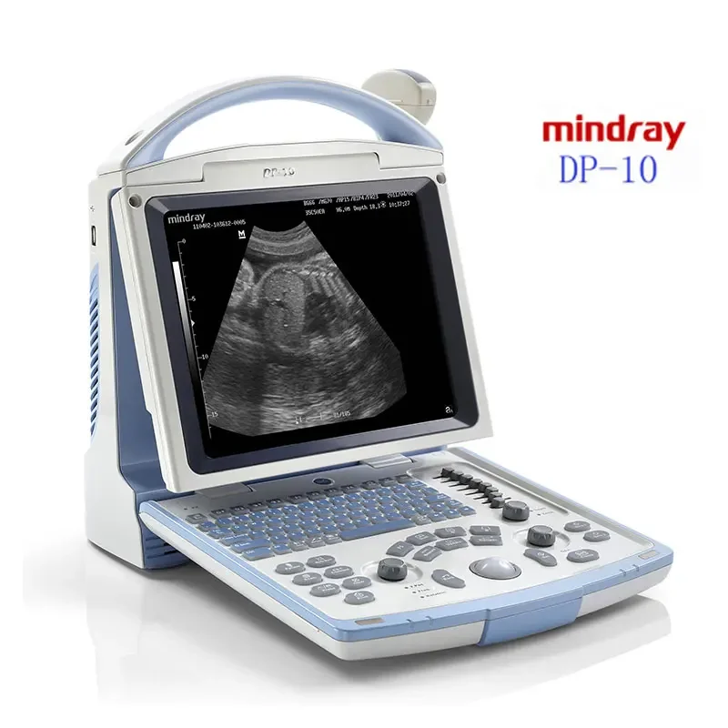 Mindray Portable Medical Ultrasonido Sonografo Portatil Ecografo Mindray Dp 10 Ultrasound Machine