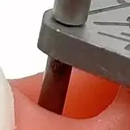 

Medical Dental Implant Parallel Pin Gauge Stainless Steel Lacator Dental Implant Locatring Guide Locating Ruler