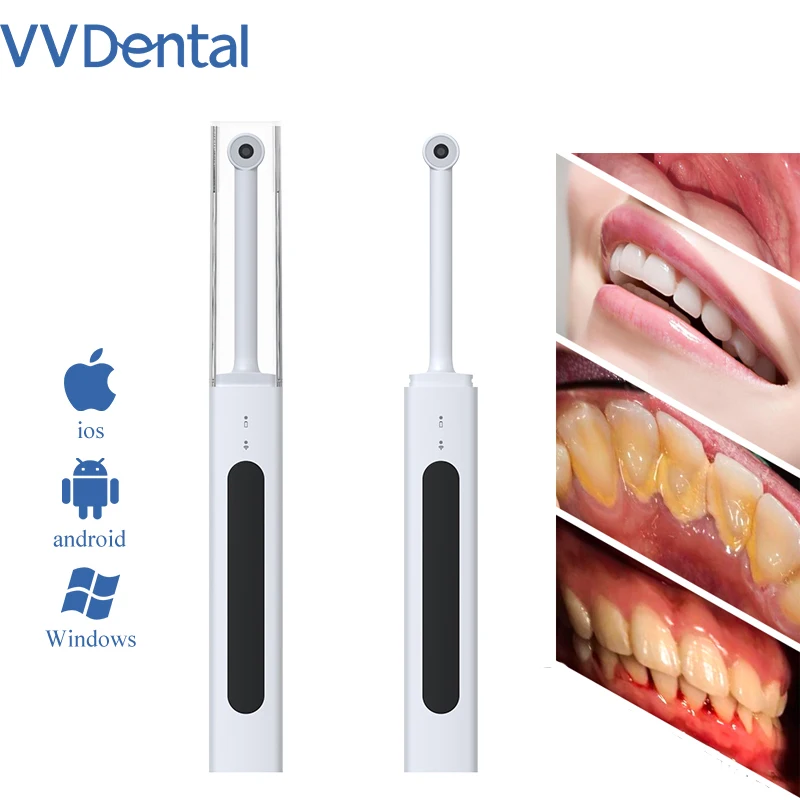 VVDental Intraoral Dental Camera Wireless Wifi Oral Endoscope 300W Intraoral Camera Teeth Endoscope HD Video for Android PC