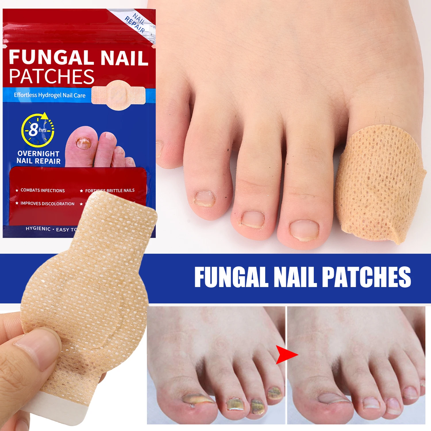 21/105 pçs prego fungo remendo tratamento de fungos da unha adesivos à prova dwaterproof água correção encravada danificado cinza unhas pés cuidados ferramenta