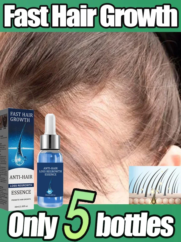 Fast Hair Growth Oil Effective Baldness Repair Hereditary Hair Loss Postpartum Hair Loss Seborrheic