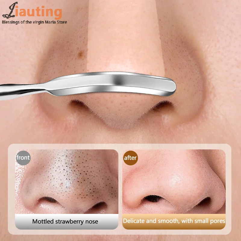 1 ชิ้น Blackhead Remover สิว Popper เครื่องมือเข็มสิวถอด Treatment Whitehead Popping Zit จมูก Blemish Extractor เครื่องมือ