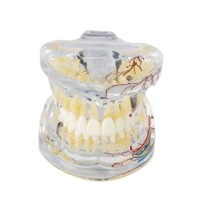 Dental Pathologies Teeth Model with Nerve for Demonstration Dentistry Education Teaching Models Students Practice Products M4019