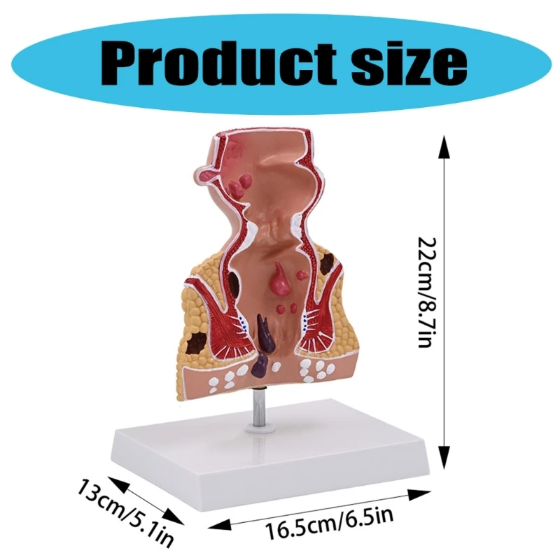 Модель человеческих патологий прямой кишки Модель прямой кишки человека Модель обучения медицине
