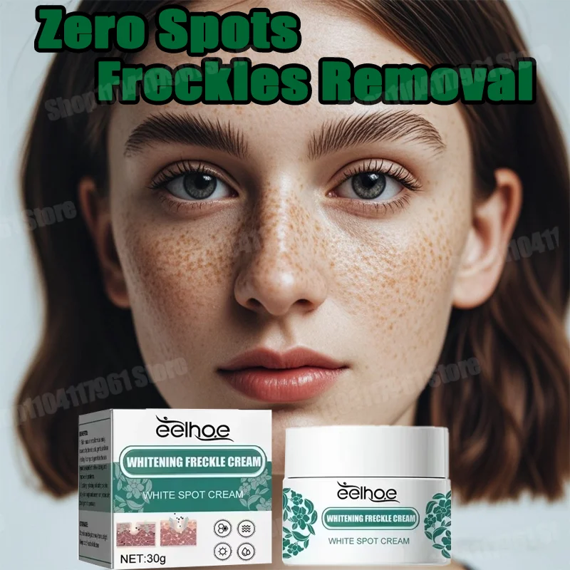 

Whitening Freckle Cream Niacinamide Remove Dark Spot Cream Anti Freckle and Aging Cream Brighten Fade Pigmentation Melasma
