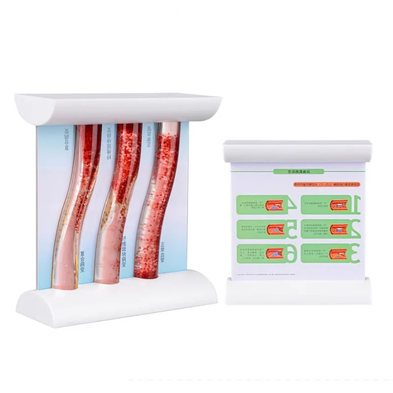 Dynamic Blood Vessel Model Cardiovascular Blockage Contrast Model Thrombosis Model Teaching Tool