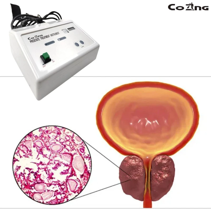 

Prostate Therapy Device with Qihai and Huiyin Acupoint Stimulation for Chronic Discomfort Low Frequency Pulse Technology