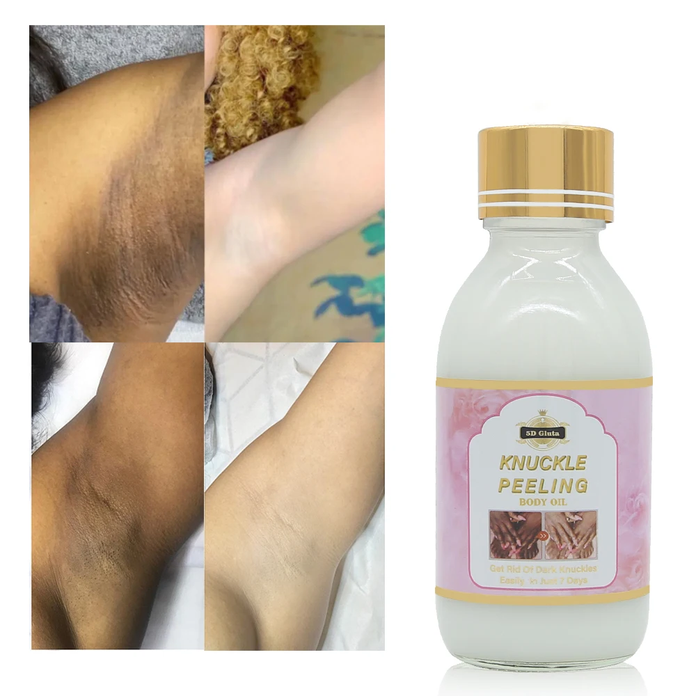 

Knuckle Whinteing Serum Dark Spot Removal Body Oil Flawless Skin Care Body Whitening Lotion for Knees, elbows, Armpits