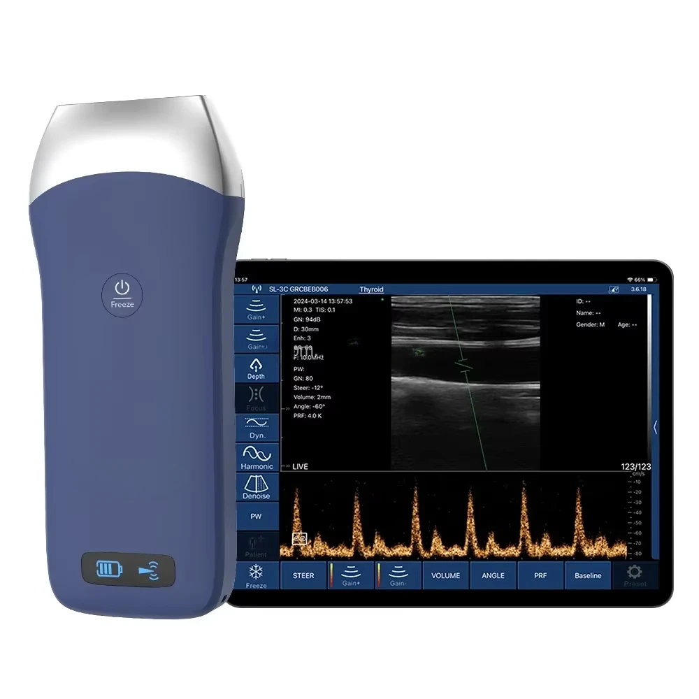 

128 Elements Ultrasound Linear Probe 7.5/10mhz Wireless Ultrasound Handheld Ultrasound Scanner Working With Phone